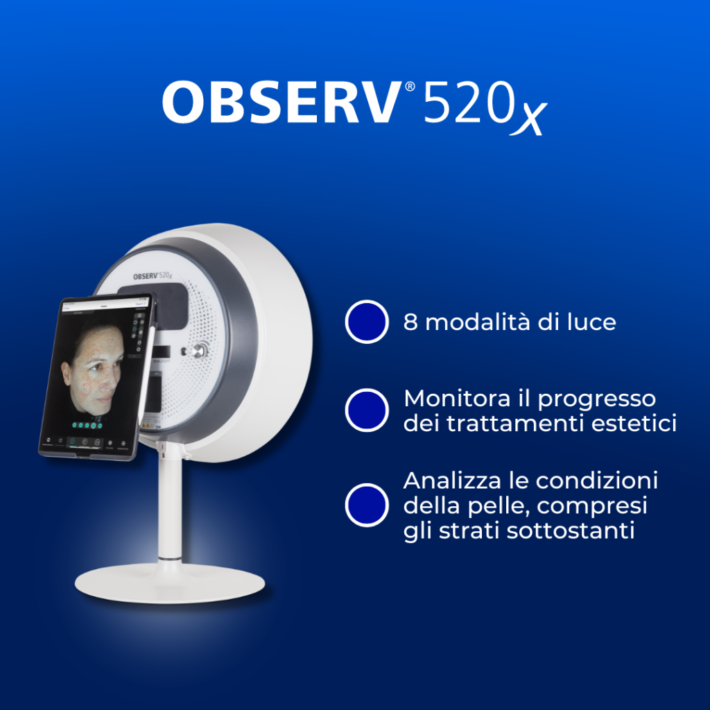 observ520x benefici
